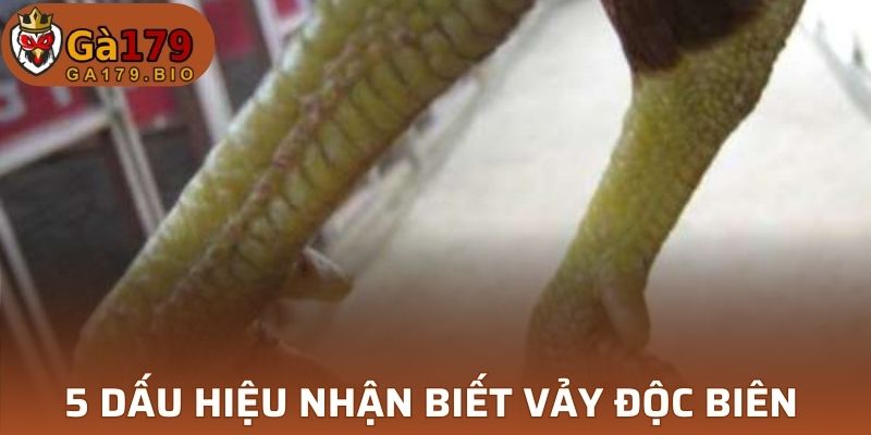 5 dấu hiệu nhận biết vảy Độc Biên 